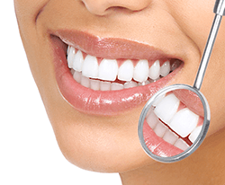 Teeth Cleaning and Polishing