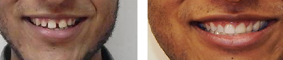 Case 14