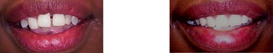 Case 5