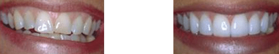 Case 6
