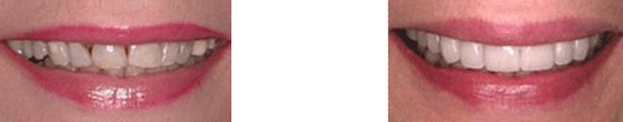 Case 7