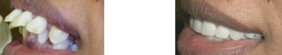 Case 8